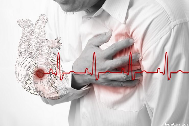 Kalp krizi - Nedenleri