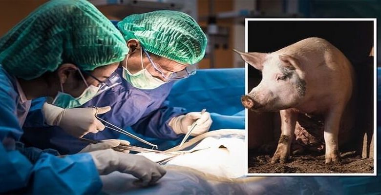 İlk kez domuz böbreği insana nakledildi