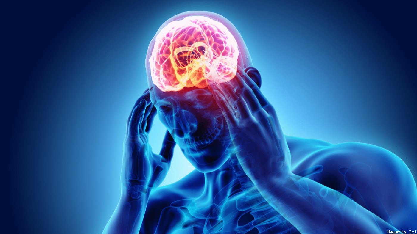 Migrenden Kurtulmak: Önleyici ve Akut Tedaviler