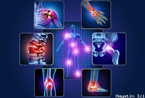 Osteoartrit (Kireçlenme) Hakkında Bilmeniz Gereken Her Şey