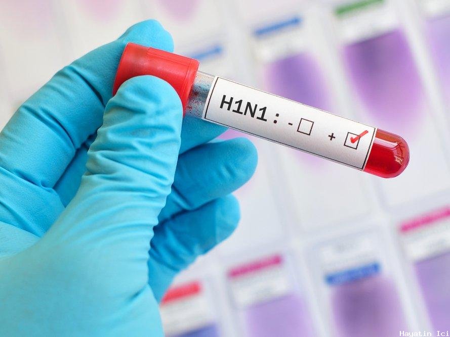 H1N1 gribi ( domuz gribi )